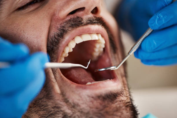 Best Emergency Dentist for Special Needs Patients in Mount Carmel, OH